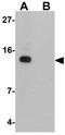 DET1 And DDB1 Associated 1 antibody, GTX32030, GeneTex, Western Blot image 