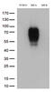 MHC Class I Polypeptide-Related Sequence A antibody, TA813273, Origene, Western Blot image 