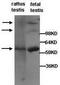 Piwi-like protein 1 antibody, TA310121, Origene, Western Blot image 