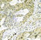 Heat Shock Protein Family A (Hsp70) Member 9 antibody, GTX13529, GeneTex, Immunohistochemistry paraffin image 