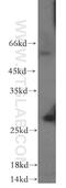 RAB7B, Member RAS Oncogene Family antibody, 12283-1-AP, Proteintech Group, Western Blot image 