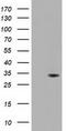 Uridine-Cytidine Kinase 1 antibody, CF501541, Origene, Western Blot image 