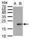 Ubiquitin-conjugating enzyme E2 B antibody, GTX100416, GeneTex, Western Blot image 