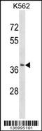 Single-strand selective monofunctional uracil DNA glycosylase antibody, 59-190, ProSci, Western Blot image 