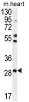 Ring Finger Protein 183 antibody, AP53687PU-N, Origene, Western Blot image 