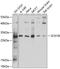 Sodium channel subunit beta-1 antibody, A03061, Boster Biological Technology, Western Blot image 
