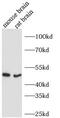 Arrestin Beta 2 antibody, FNab00876, FineTest, Immunohistochemistry paraffin image 