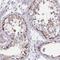 Zinc Finger Protein 778 antibody, HPA057151, Atlas Antibodies, Immunohistochemistry frozen image 