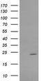 RAB30, Member RAS Oncogene Family antibody, TA505347BM, Origene, Western Blot image 