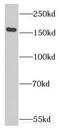 Eukaryotic Translation Initiation Factor 5B antibody, FNab02730, FineTest, Western Blot image 