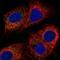 Mitochondrial Calcium Uptake 1 antibody, NBP2-58173, Novus Biologicals, Immunocytochemistry image 