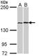 FA Complementation Group A antibody, LS-B12475, Lifespan Biosciences, Western Blot image 