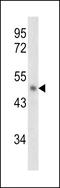 SERPINB2 antibody, LS-C99290, Lifespan Biosciences, Western Blot image 