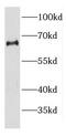 Probable ATP-dependent RNA helicase DDX56 antibody, FNab02316, FineTest, Western Blot image 