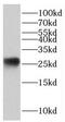 Hematological and neurological expressed 1 protein antibody, FNab03940, FineTest, Western Blot image 