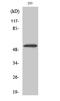 Cyclin Dependent Kinase 8 antibody, A01493, Boster Biological Technology, Western Blot image 