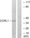Atypical Chemokine Receptor 4 antibody, LS-C120559, Lifespan Biosciences, Western Blot image 