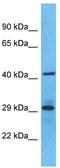 Olfactory Receptor Family 6 Subfamily S Member 1 antibody, TA337541, Origene, Western Blot image 