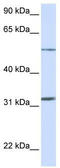Solute Carrier Family 35 Member A5 antibody, TA333764, Origene, Western Blot image 