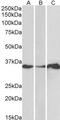 LIM and SH3 domain protein 1 antibody, GTX21301, GeneTex, Western Blot image 