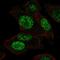 Phosphoglycerate Mutase 1 antibody, HPA060483, Atlas Antibodies, Immunocytochemistry image 