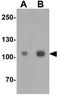 Endoplasmic Reticulum Aminopeptidase 1 antibody, GTX31553, GeneTex, Western Blot image 