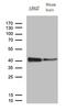 Dscr1 antibody, M02795, Boster Biological Technology, Western Blot image 