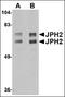 Junctophilin 2 antibody, AP23013PU-N, Origene, Western Blot image 