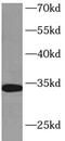 H12 antibody, FNab03884, FineTest, Western Blot image 