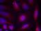 Neurotrophic Receptor Tyrosine Kinase 1 antibody, PA5-37672, Invitrogen Antibodies, Immunofluorescence image 