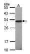 Glutathione S-Transferase Omega 1 antibody, TA308286, Origene, Western Blot image 