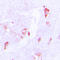 Cysteine And Serine Rich Nuclear Protein 2 antibody, LS-C353576, Lifespan Biosciences, Immunohistochemistry paraffin image 