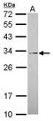 Polypeptide N-acetylgalactosaminyltransferase 12 antibody, PA5-31582, Invitrogen Antibodies, Western Blot image 