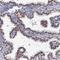 Chromosome 11 Open Reading Frame 96 antibody, HPA038843, Atlas Antibodies, Immunohistochemistry paraffin image 