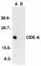 Cell Death Inducing DFFA Like Effector A antibody, TA305986, Origene, Western Blot image 