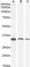 B36-VDAC antibody, NB300-871, Novus Biologicals, Western Blot image 