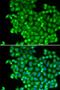 Lactate Dehydrogenase A antibody, LS-C331295, Lifespan Biosciences, Immunofluorescence image 