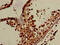 Protein OS-9 antibody, CSB-PA613402LA01HU, Cusabio, Immunohistochemistry paraffin image 