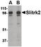 SLIT And NTRK Like Family Member 2 antibody, PA5-20471, Invitrogen Antibodies, Western Blot image 