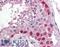 Cullin-4A antibody, LS-B360, Lifespan Biosciences, Immunohistochemistry paraffin image 