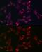 BH3 Interacting Domain Death Agonist antibody, GTX32471, GeneTex, Immunofluorescence image 