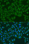 Inositol Polyphosphate-5-Phosphatase K antibody, 23-196, ProSci, Immunofluorescence image 