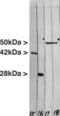Vimentin antibody, LS-C204599, Lifespan Biosciences, Western Blot image 