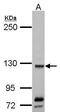 SMC5-SMC6 Complex Localization Factor 1 antibody, PA5-31991, Invitrogen Antibodies, Western Blot image 