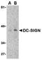 CD209 Molecule antibody, orb75850, Biorbyt, Western Blot image 