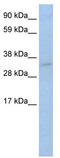 p53 antibody, TA342298, Origene, Western Blot image 