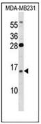 Guanylate Cyclase Activator 2B antibody, AP51983PU-N, Origene, Western Blot image 