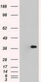 Mitogen-Activated Protein Kinase 1 antibody, TA500470S, Origene, Western Blot image 
