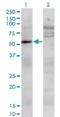 Uridine Monophosphate Synthetase antibody, H00007372-M05, Novus Biologicals, Western Blot image 