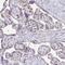 Lin-28 Homolog B antibody, NBP2-32352, Novus Biologicals, Immunohistochemistry frozen image 